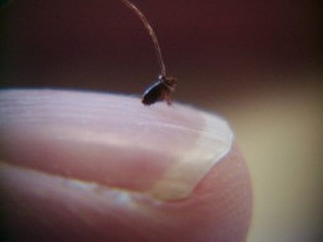 5531355_f260.jpg